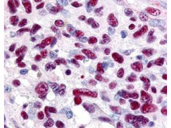 GLI3 Antibody