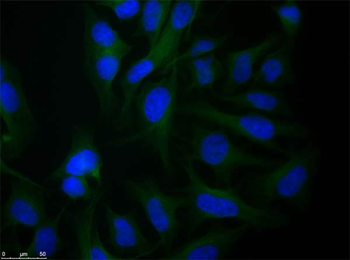 TUBA1B Antibody