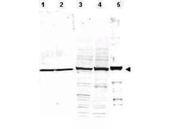 TUBA1B Antibody