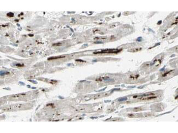 PPP1R13L Antibody
