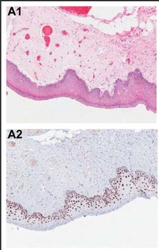 PDCD4 Antibody