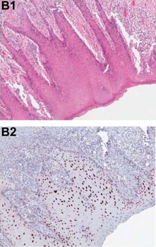PDCD4 Antibody