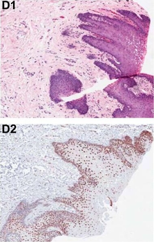 PDCD4 Antibody