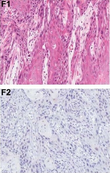 PDCD4 Antibody
