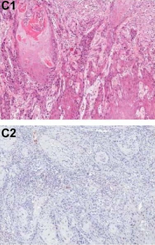 PDCD4 Antibody