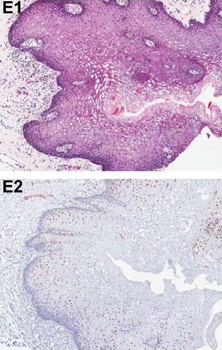 PDCD4 Antibody