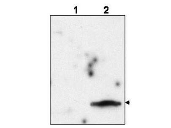 gag Antibody