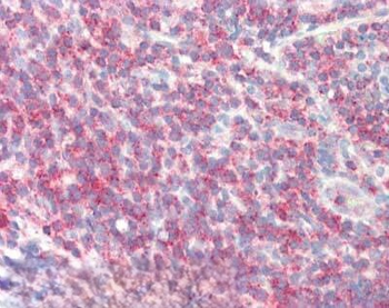Sipa1 Antibody