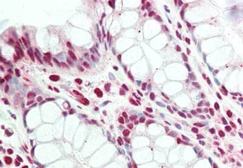 PRDM1 Antibody