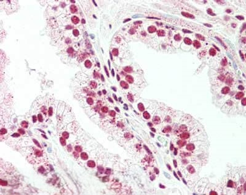 PRDM1 Antibody