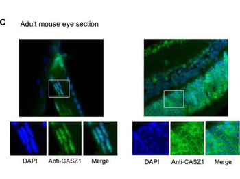 CASZ1 Antibody