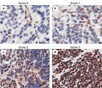 CASZ1 Antibody