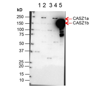 CASZ1 Antibody