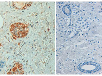 STAT6 Antibody