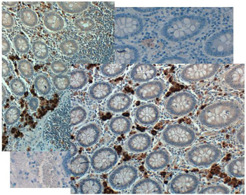 GDF15 Antibody (Biotin)