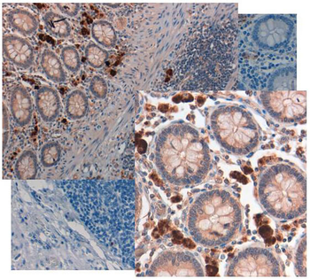 GDF15 Antibody (Biotin)