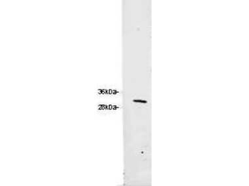 DsRed Antibody