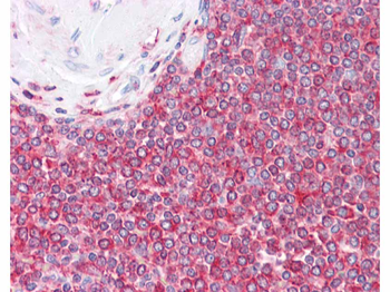 ACTB Antibody