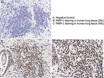 PARP1 Antibody