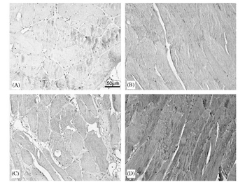 TNF Antibody