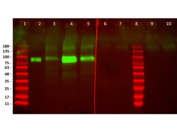 Recombinant HER2 Fab Antibody