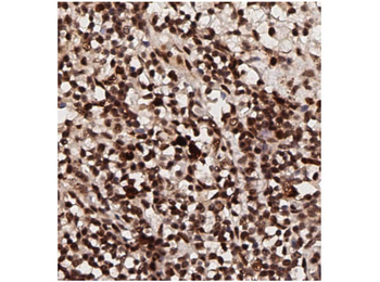 AKT1 Antibody