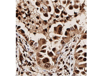 AKT1 Antibody