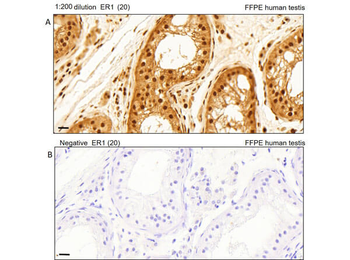AKT1 Antibody