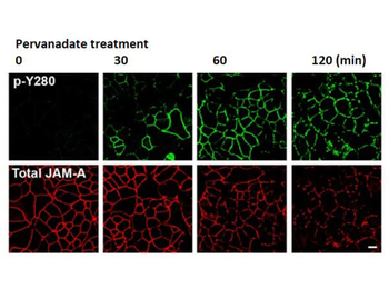 F11R Antibody