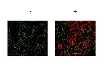 F11R Antibody