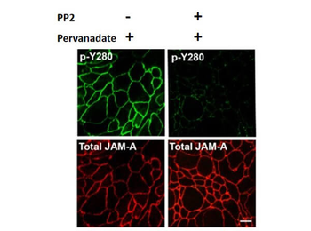 F11R Antibody