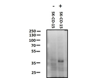 F11R Antibody