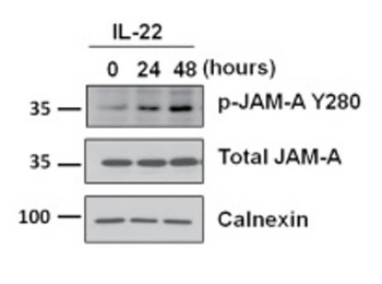 F11R Antibody