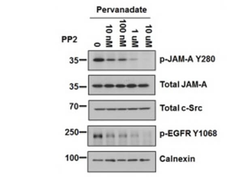 F11R Antibody