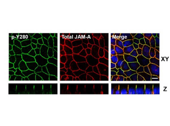 F11R Antibody