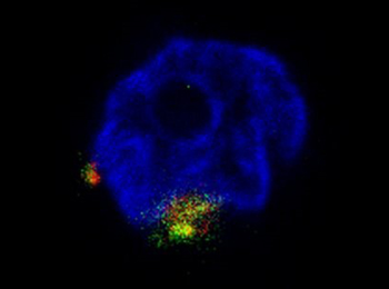 Ngp Antibody
