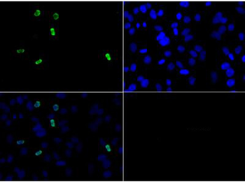 HIST2H3C Antibody