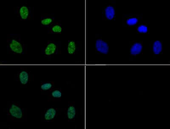 HIST2H3C Antibody