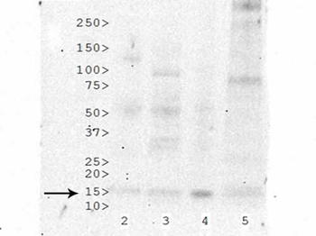 HIST2H3C Antibody