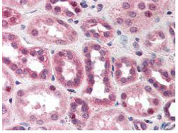 CUL5 Antibody