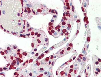 HIST1H3A Antibody