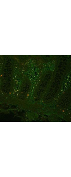 TNF Antibody