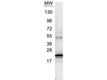 IL6 Antibody