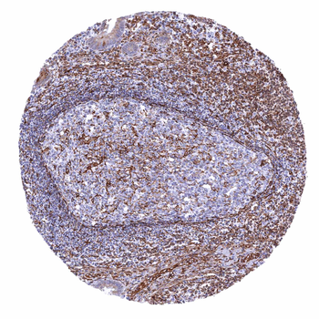 STING1 antibody