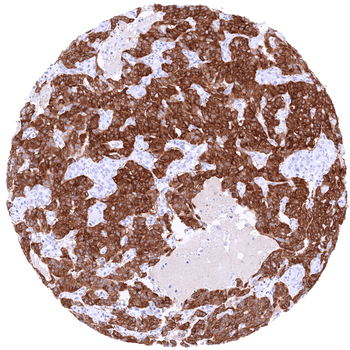 GAD2 / GAD65 antibody