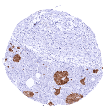 GAD2 / GAD65 antibody