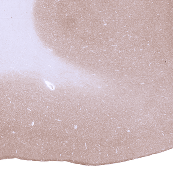 GAD2 / GAD65 antibody