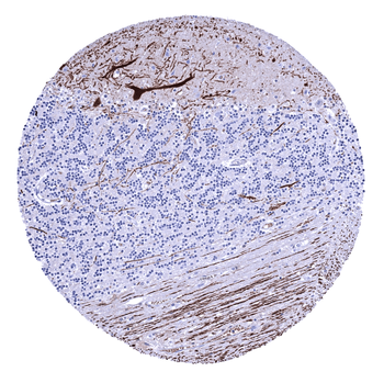 Calbindin 1 antibody