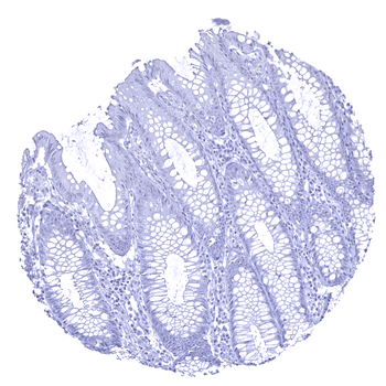Calbindin 1 antibody