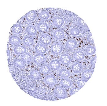 Factor XIII alpha antibody